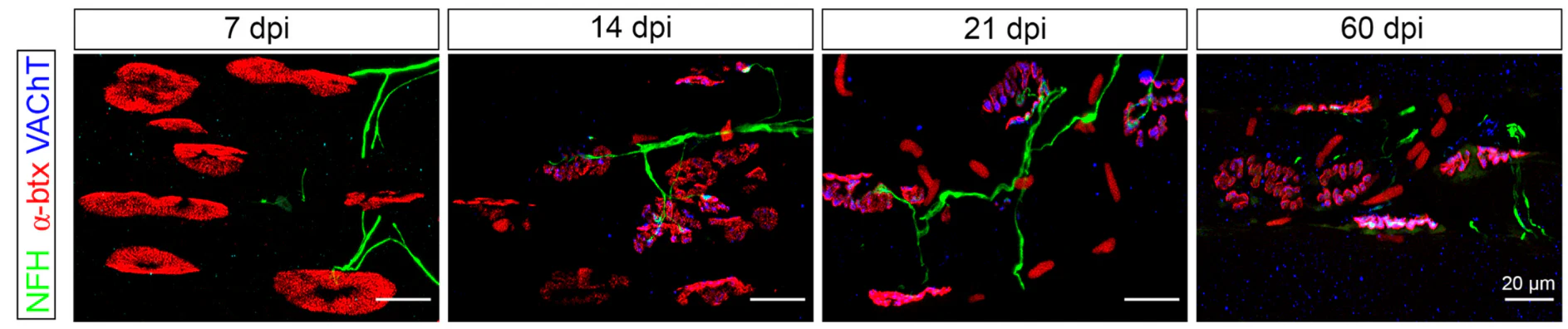 Anti-NFH (Neurofilament Heavy Chain) Antibody - Image 4