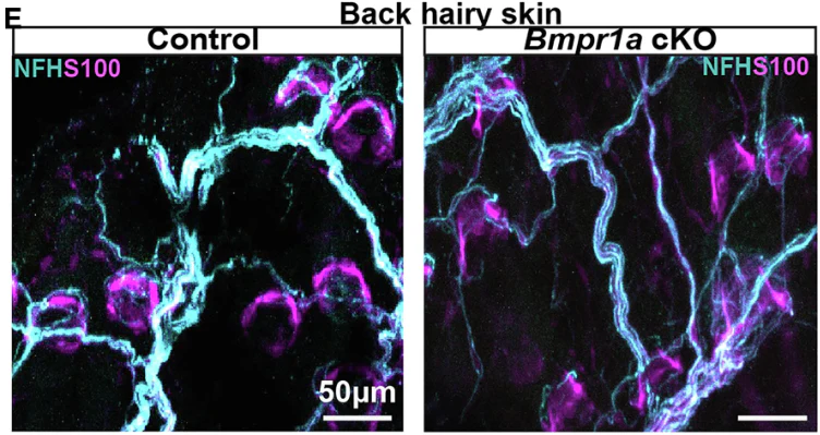 Anti-NFH (Neurofilament Heavy Chain) Antibody - Image 5