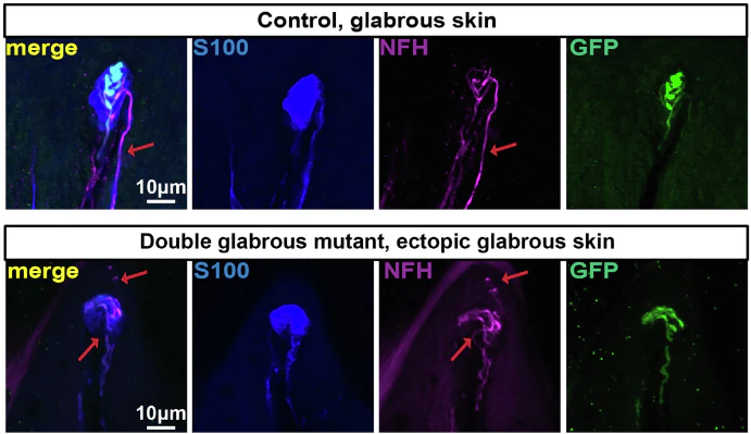 Anti-NFH (Neurofilament Heavy Chain) Antibody - Image 6