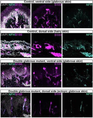 Anti-NFH (Neurofilament Heavy Chain) Antibody - Image 7