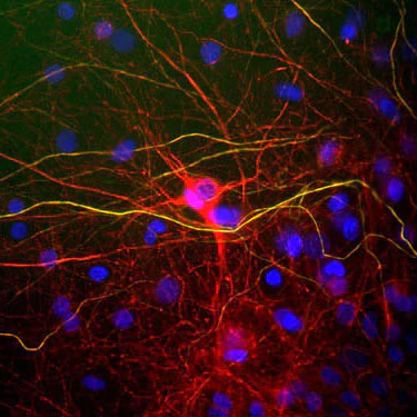 Anti-NFL (Neurofilament Light Chain) Antibody