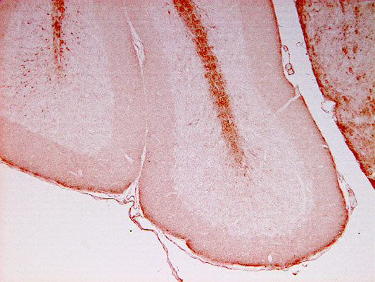 Anti-NFL (Neurofilament Light Chain) Antibody - Image 2