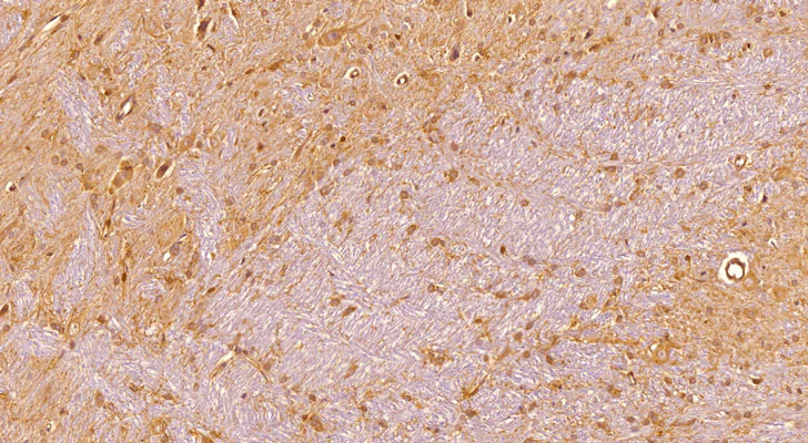Anti-NG2/CSPG4 Antibody