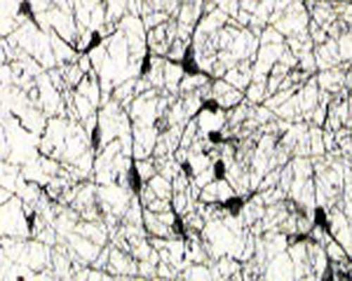 Anti-NGFR/p75 Neurotrophin Receptor (p75NTR) Antibody - Image 2
