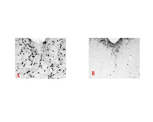 Anti-NGFR/p75 neurotrophin receptor (p75NTR) Antibody (Saporin)