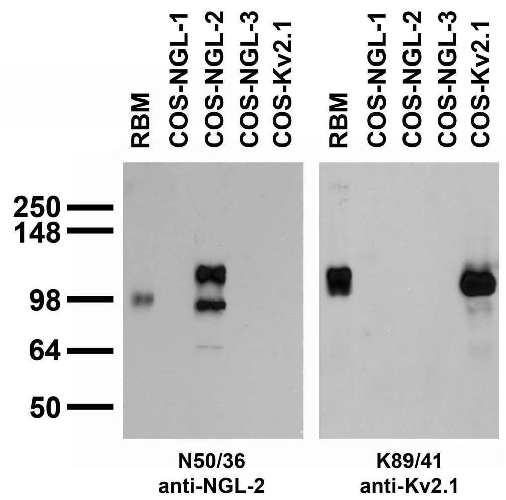 Anti-NGL-2/LRRC4 Antibody - Image 2