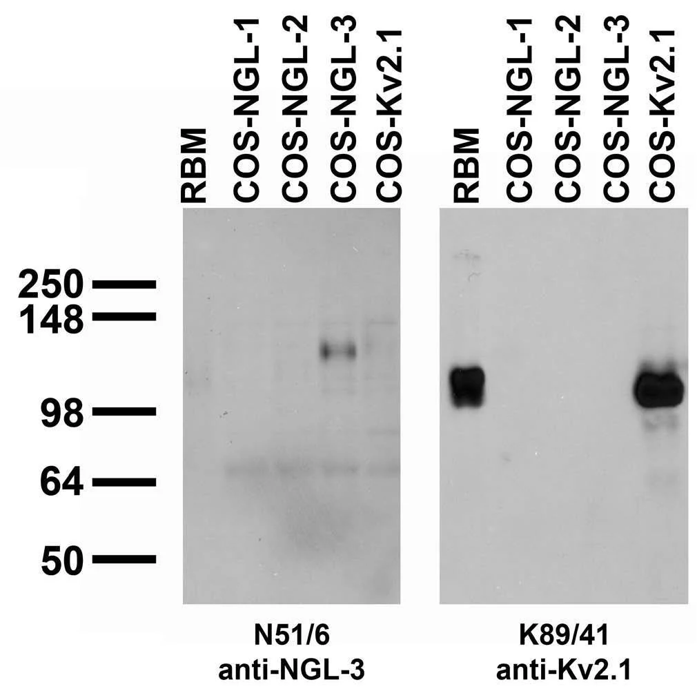 Anti-NGL-3/LRRC4B Antibody