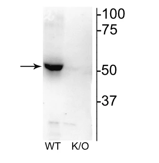 Anti-Nicotinic Acetylcholine Receptor (nAChR) β2 Antibody