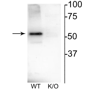 Anti-Nicotinic Acetylcholine Receptor (nAChR) β4 Antibody
