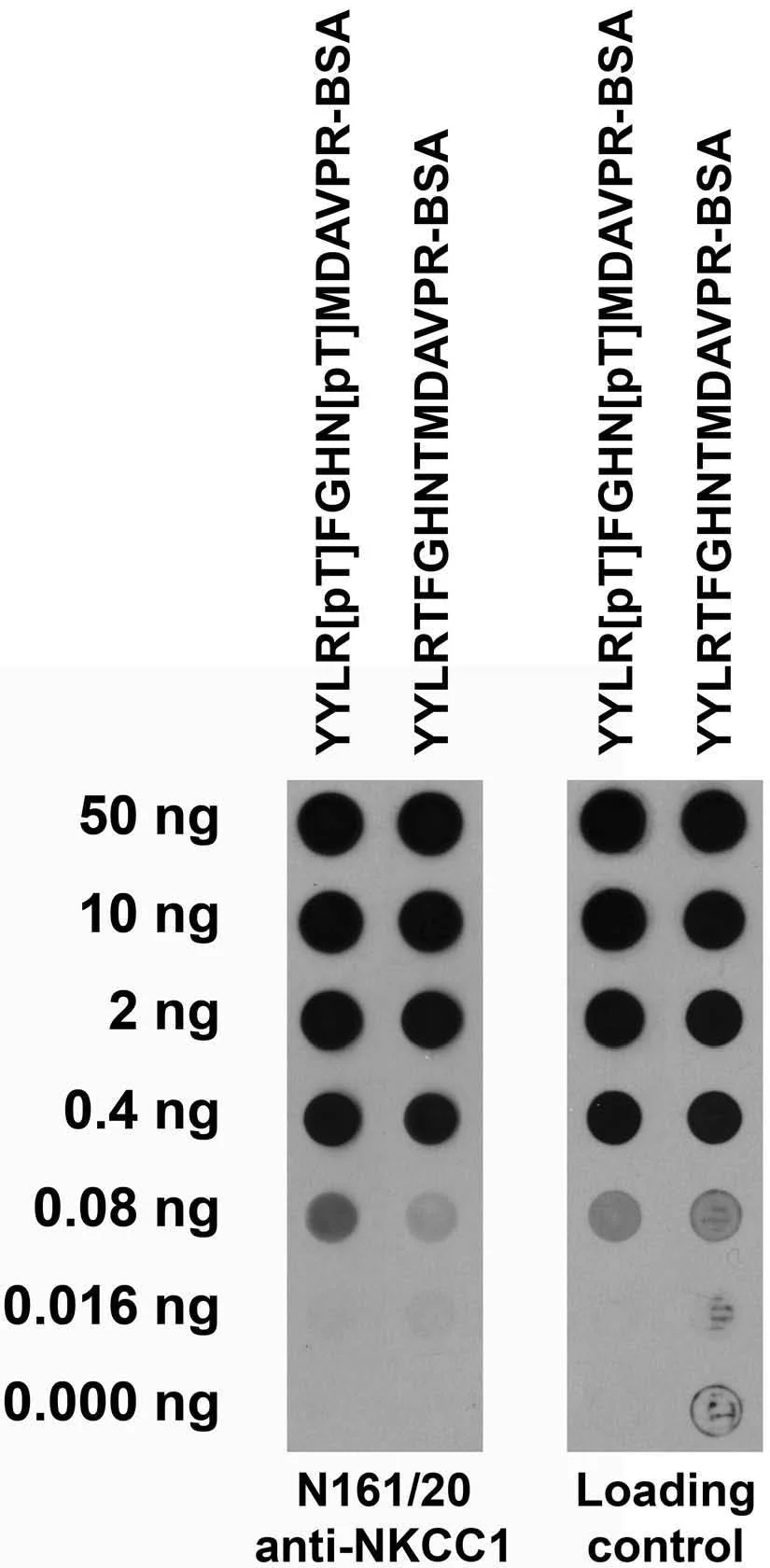 Anti-NKCC1 Antibody