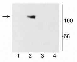 Anti-NMDA NR1 Subunit, Splice Variant C2 Antibody
