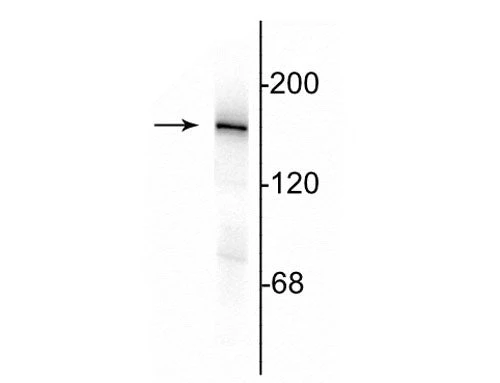 Anti-NMDA NR2A Subunit Antibody