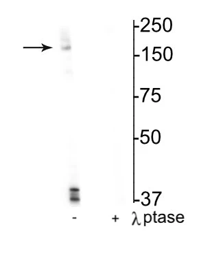 Anti-NMDA NR2B Subunit (Ser1166) Antibody