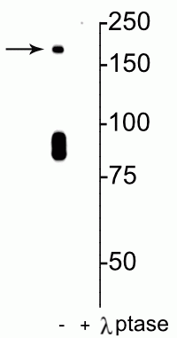 Anti-NMDA NR2B Subunit (Ser1480) Antibody