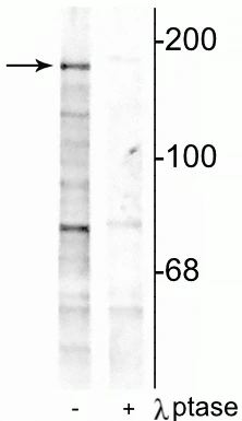 Anti-NMDA NR2B Subunit (Tyr1252) Antibody