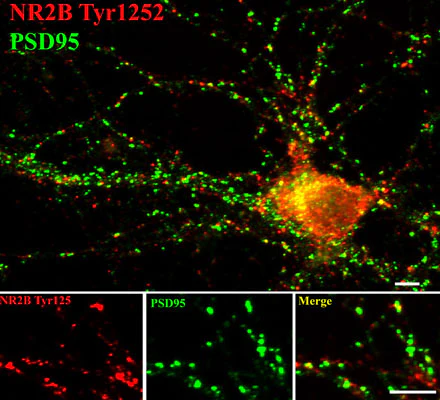 Anti-NMDA NR2B Subunit (Tyr1252) Antibody - Image 2