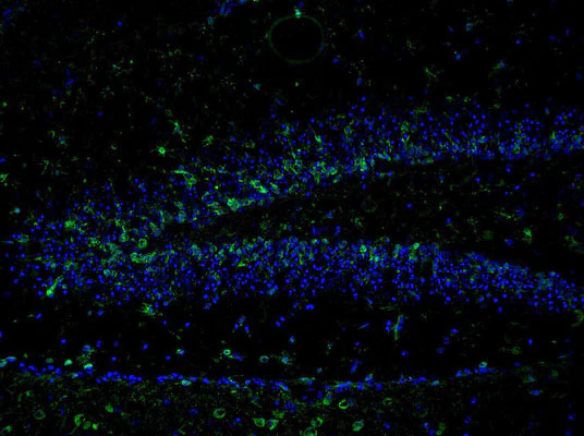 Anti-NMDA NR2B Subunit (Tyr1336) Antibody - Image 2