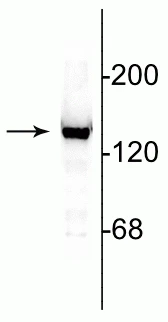 Anti-NMDA NR2C Subunit Antibody