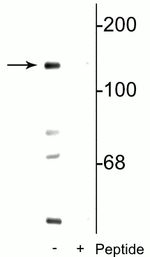 Anti-NMDA NR2C Subunit (Ser1096) Antibody
