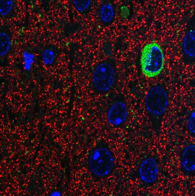 Anti-nNOS/NOS1 Antibody