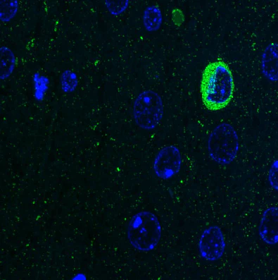 Anti-nNOS/NOS1 Antibody - Image 2
