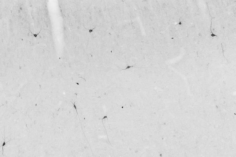 Anti-nNOS/NOS1 Antibody - Image 2