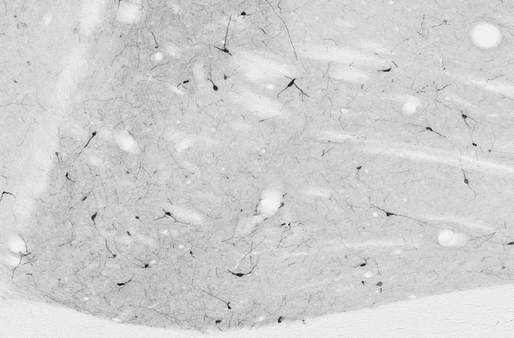 Anti-nNOS/NOS1 Antibody - Image 4