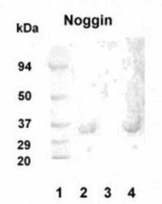 Anti-Noggin Antibody