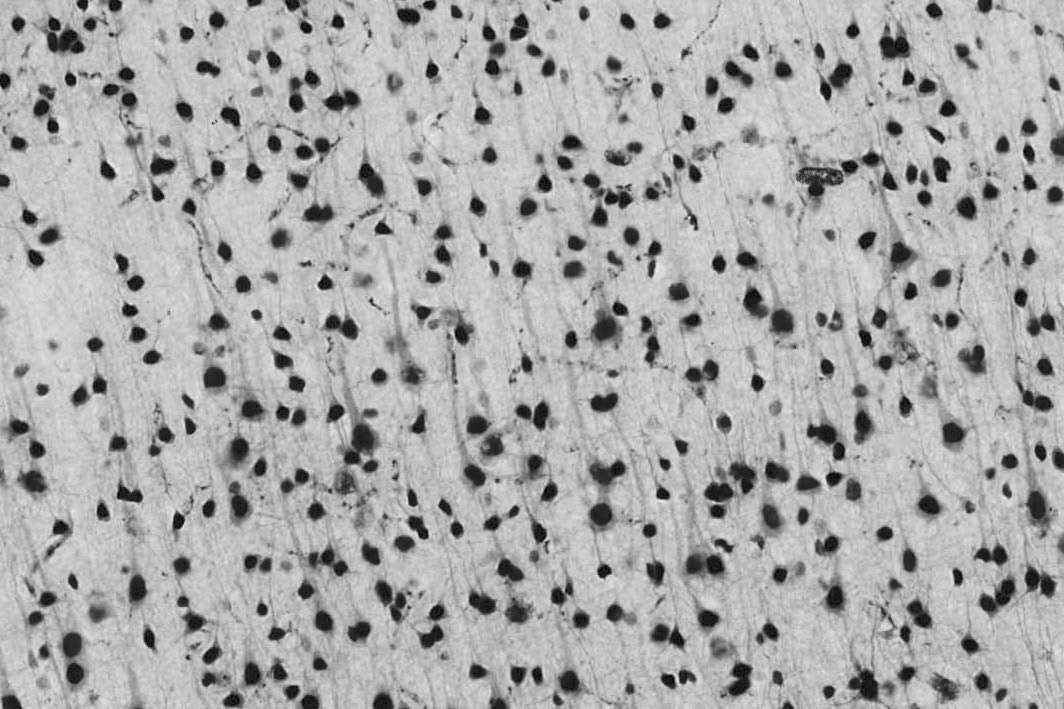 Anti-Npas4 Antibody - Image 2