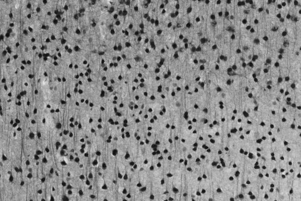 Anti-Npas4 Antibody - Image 2