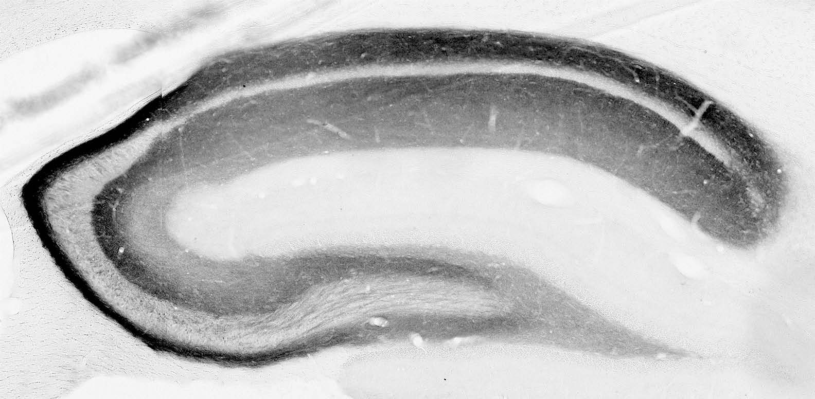 Anti-NPY2R Antibody