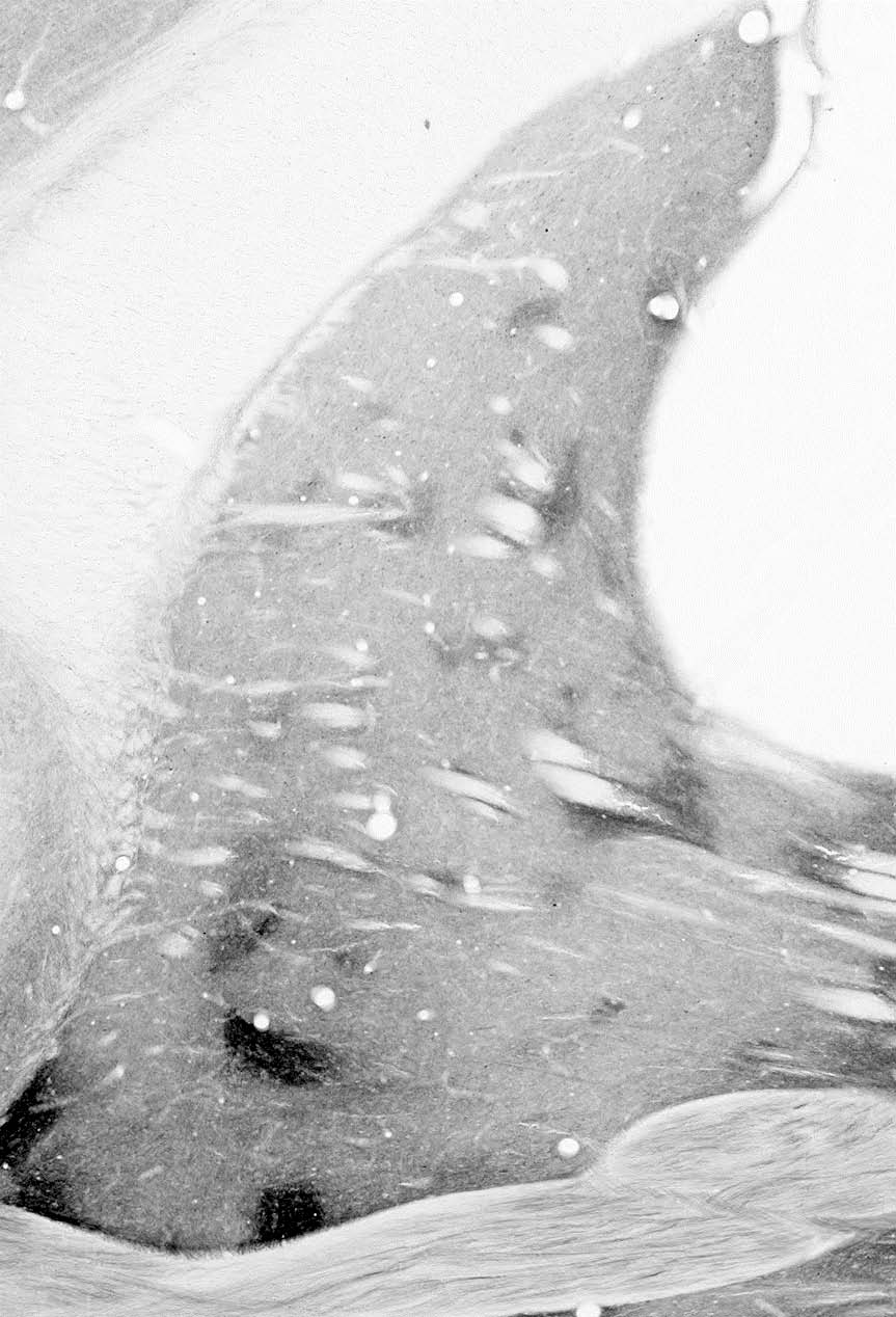 Anti-NPY2R Antibody - Image 2