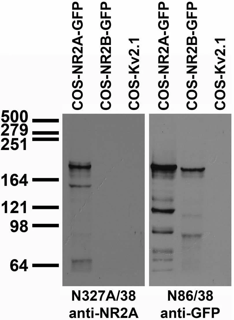 Anti-NR2A Glutamate Receptor Antibody