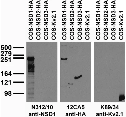 Anti-NSD1 Antibody
