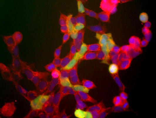 Anti-NSE (Neuron specific enolase) Antibody - Image 2