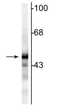 Anti-NSE (Neuron specific enolase) Antibody - Image 3