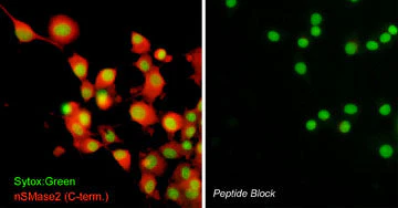 Anti-nSMase2 (C-terminal region) Antibody - Image 2
