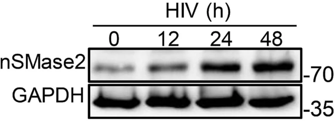 Anti-nSMase2 (C-terminal region) Antibody - Image 3