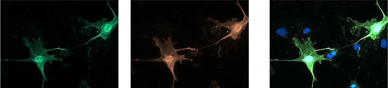 Anti-Olig2 Antibody