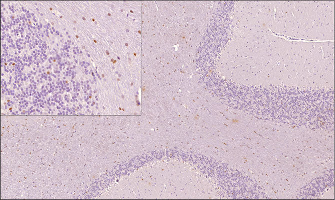 Anti-Olig2 Antibody - Image 2