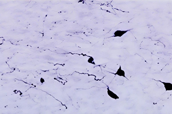 Anti-Orexin-A Antibody