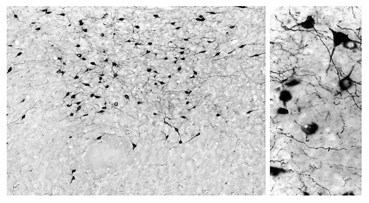 Anti-Orexin-A Antibody - Image 2