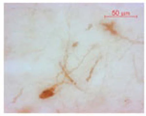 Anti-Oxytocin Antibody