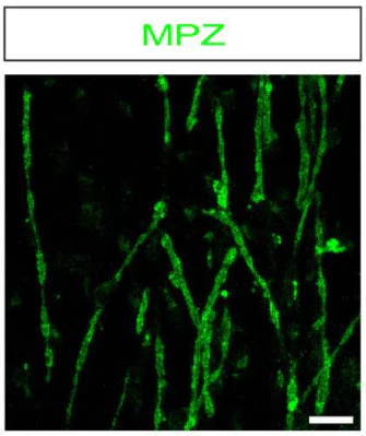 Anti-P-Zero Myelin Protein (PZO) Antibody - Image 10