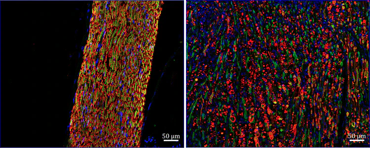 Anti-P-Zero Myelin Protein (PZO) Antibody - Image 2