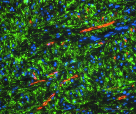 Anti-P-Zero Myelin Protein (PZO) Antibody - Image 3