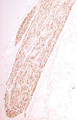 Anti-P-Zero Myelin Protein (PZO) Antibody - Image 4