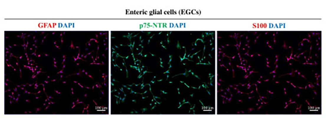 Anti-P-Zero Myelin Protein (PZO) Antibody - Image 5