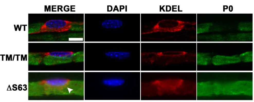 Anti-P-Zero Myelin Protein (PZO) Antibody - Image 6