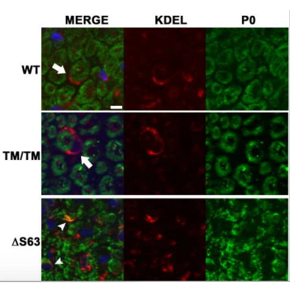 Anti-P-Zero Myelin Protein (PZO) Antibody - Image 7